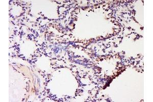 Formalin-fixed and paraffin embedded rat lung labeled with Anti-RNF56 Polyclonal Antibody, Unconjugated  at 1:200 followed by conjugation to the secondary antibody and DAB staining. (Cbl Proto-Oncogene B, E3 Ubiquitin Protein Ligase (CBLB) (AA 101-200) Antikörper)