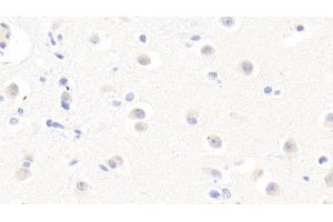 Detection of AFM in Human Cerebrum Tissue using Polyclonal Antibody to Afamin (AFM) (Afamin Antikörper  (AA 22-210))