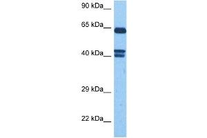 Host:  Rabbit  Target Name:  FZD10  Sample Tissue:  Human MCF7 Whole Cell  Antibody Dilution:  1ug/ml
