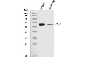 Western blot analysis of Cd86 using anti-Cd86 antibody (ABIN7601417).