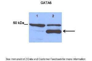 Lanes:   Lane 1: 25 ug empty vector transfected H460 cell lysate Lane 2: 25 ug hGATA5 transfected H460 cell lysate  Primary Antibody Dilution:   1:1200  Secondary Antibody:   Anti-rabbit HRP  Secondary Antibody Dilution:   1:3500  Gene Name:   GATA5  Submitted by:   Anonymous (GATA5 Antikörper  (Middle Region))