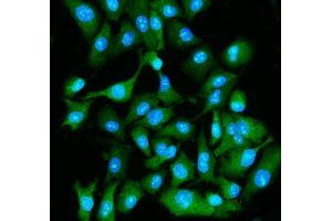 IF analysis of EIF5A using anti-EIF5A antibody (ABIN7599674).