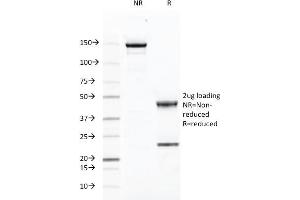 SDS-PAGE Analysis Purified CD46 Mouse Monoclonal Antibody (169-1-E4. (CD46 Antikörper)