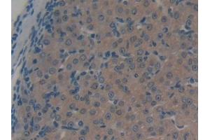 DAB staining on IHC-P; Samples: Mouse Ovary Tissue (ABCC1 Antikörper  (AA 1219-1469))