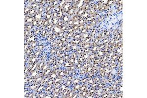 IHC analysis of SF3A1 using anti-SF3A1 antibody (ABIN7600556). (SF3A1 Antikörper  (AA 20-556))