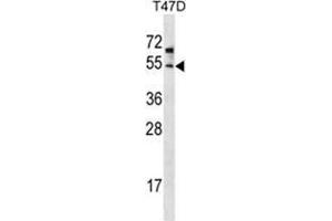 ZDHHC6 Antibody (C-term) western blot analysis in T47D cell line lysates (35 µg/lane). (ZDHHC6 Antikörper  (C-Term))