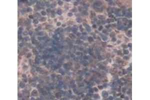 Used in DAB staining on fromalin fixed paraffin- embedded Kidney tissue (Osteocrin Antikörper  (AA 26-130))