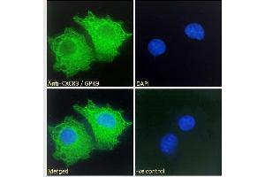 Immunofluorescence (IF) image for anti-Chemokine (C-X-C Motif) Receptor 3 (CXCR3) (C-Term) antibody (ABIN334381)