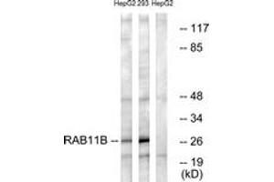 Western blot analysis of extracts from HepG2/293 cells, using RAB11B Antibody. (RAB11B Antikörper  (AA 164-213))