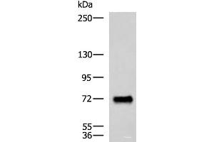 Western blot analysis of Human fetal brain tissue lysate using PPEF1 Polyclonal Antibody at dilution of 1:1500 (PPEF1 Antikörper)