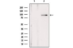 Western blot analysis of extracts from 293, using ANO1 Antibody. (ANO1 Antikörper  (Internal Region))