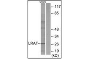 Western blot analysis of extracts from COLO205 cells, using LRAT Antibody . (LRAT Antikörper  (Internal Region))