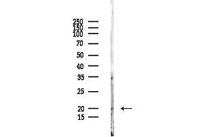 anti-Integrin beta 3 Binding Protein (Beta3-Endonexin) (ITGB3BP) (Internal Region) antibody