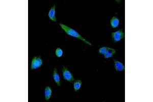 IF analysis of P Glycoprotein using anti-P Glycoprotein antibody (ABIN5693064). (ABCB1 Antikörper)
