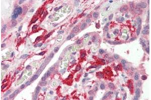 Human Placenta (formalin-fixed, paraffin-embedded) stained with AIF1 antibody ABIN337130 at 2. (Iba1 Antikörper  (AA 138-148))