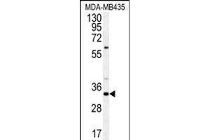 Western blot analysis of SGF29 Antibody (C-term) (ABIN651333 and ABIN2840193) in MDA-M cell line lysates (35 μg/lane). (SGF29 Antikörper  (C-Term))