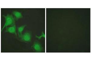 Immunofluorescence analysis of HuvEc cells, using NFE2L2 antibody (ABIN5976469). (NRF2 Antikörper  (C-Term))