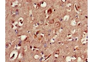 Immunohistochemistry of paraffin-embedded human brain tissue using ABIN7147793 at dilution of 1:100 (CLOCK Antikörper  (AA 577-846))