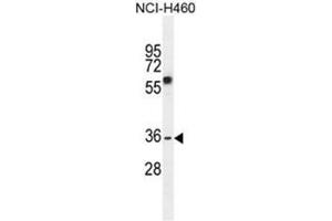 C10orf72 Antibody (Center) western blot analysis in NCI-H460 cell line lysates (35µg/lane).