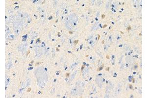 ABIN6260194 and ABIN6272676 at 1/100 staining Mouse brain tissue by IHC-P. (BAI3 Antikörper  (Internal Region))