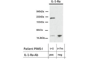 WB of IL-1-Ra of total plasma protein in a native, gradient gel under non-reducing conditions of patient MIS-C-I at presentation with acute inflammation and seropositive for IL-1-Ra-Abs of IgG class and 7 months later without IL-1-Ra-Abs. (IL1RN Antikörper)