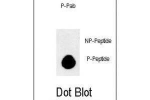 Dot Blot (DB) image for anti-APG8b (pThr93), (pTyr99) antibody (ABIN3001933) (APG8b (pThr93), (pTyr99) Antikörper)
