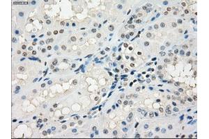 Immunohistochemical staining of paraffin-embedded Kidney tissue using anti-GBP2mouse monoclonal antibody.
