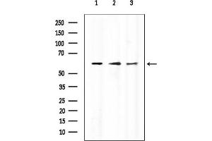 anti-Gasdermin A (GSDMA) antibody