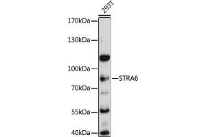 Western blot analysis of extracts of 293T cells, using STR antibody (ABIN6133187, ABIN6148633, ABIN6148634 and ABIN6215704) at 1:3000 dilution. (STRA6 Antikörper  (AA 538-667))