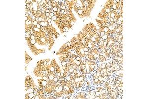Immunohistochemistry analysis of paraffin-embedded mouse colon using LI Cadherin (ABIN7074493) at dilution of 1: 1500 (LI Cadherin Antikörper)