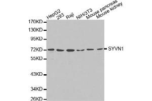 Western blot analysis of extracts of various cell lines, using SYVN1 antibody (ABIN5971424). (SYVN1 Antikörper)