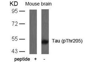 Western blot analysis of extracts from mouse brain tissue using Tau(Phospho-Thr205) Antibody and the same antibody preincubated with blocking peptide. (MAPT Antikörper  (pThr205))