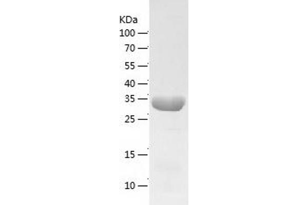 OTC Protein (AA 33-354) (His tag)