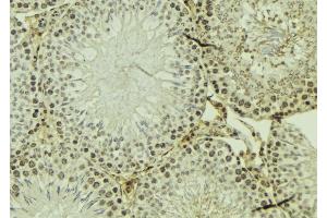 ABIN6274119 at 1/100 staining Mouse testis tissue by IHC-P. (TRIM3 Antikörper  (Internal Region))