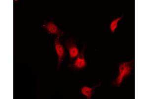 ABIN6267233 staining NIH-3T3 by IF/ICC. (HDAC3 Antikörper  (pSer424))