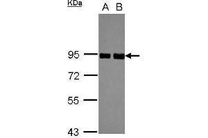 WB Image Sample (30 ug of whole cell lysate) A: A549 B: HeLa 7. (PRKCSH Antikörper)