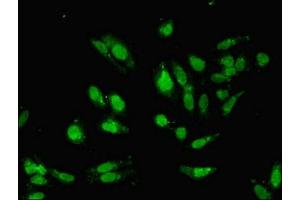 Immunofluorescent analysis of Hela cells using ABIN7155327 at dilution of 1:100 and Alexa Fluor 488-congugated AffiniPure Goat Anti-Rabbit IgG(H+L) (HDAC8 Antikörper  (AA 1-377))