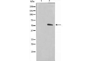 Western blot analysis on COS7 cell lysate using Keratin 15 Antibody，The lane on the left is treated with the antigen-specific peptide.