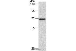 Western blot analysis of Mouse liver tissue, using SOX13 Polyclonal Antibody at dilution of 1:800 (SOX13 Antikörper)