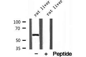 Western blot analysis of extracts of rat liver tissue, using D2HGDH antibody. (D2HGDH Antikörper  (C-Term))