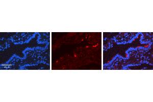 Rabbit Anti-SCGB1A1 Antibody   Formalin Fixed Paraffin Embedded Tissue: Human Lung Tissue Observed Staining: Cytoplasm, Plasma membrane Primary Antibody Concentration: 1:600 Other Working Concentrations: N/A Secondary Antibody: Donkey anti-Rabbit-Cy3 Secondary Antibody Concentration: 1:200 Magnification: 20X Exposure Time: 0. (SCGB1A1 Antikörper  (Middle Region))