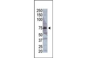 Image no. 1 for anti-Acyl-CoA Synthetase Long-Chain Family Member 4 (ACSL4) (AA 244-274) antibody (ABIN357780) (ACSL4 Antikörper  (AA 244-274))