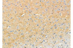 ABIN6261368 and ABIN6273232 at 1/100 staining Rat brain tissue by IHC-P. (DBN1 Antikörper  (Internal Region))