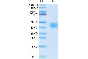 Cynomolgus carbonic anhydrase XII on Tris-Bis PAGE under reduced condition. (CA12 Protein (AA 25-299) (His tag))