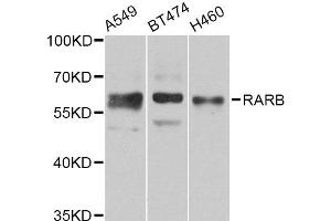 Western blot analysis of extracts of various cell lines, using RARB Antibody (ABIN5975866) at 1/1000 dilution. (Retinoic Acid Receptor beta Antikörper)