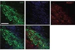 Multiplex staining of KCa3.