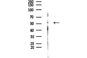 Western blot analysis of lysates from EC304 cells(heat-shock,45 min treatment), using Phospho-Parkin (Ser101) Antibody at 1/1000 dilution.