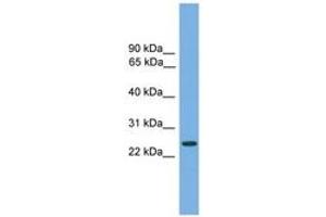 Image no. 1 for anti-Charged Multivesicular Body Protein 4B (CHMP4B) (AA 71-120) antibody (ABIN6745025) (CHMP4B Antikörper  (AA 71-120))