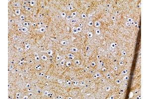 ABIN6259428 and ABIN6276242 at 1/100 staining mouse brain tissue by IHC-P.