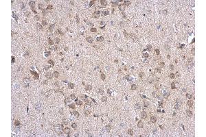 IHC-P Image INPP5F antibody detects INPP5F protein at cytosol on mouse fore brain by immunohistochemical analysis. (INPP5F Antikörper)